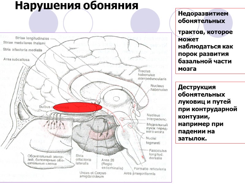 Нарушения обоняния Недоразвитием обонятельных трактов, которое может наблюдаться как порок развития базальной части мозга